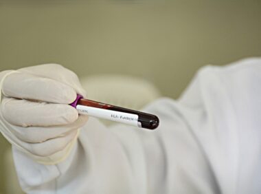 {{brizy_dc_image_alt entityId=