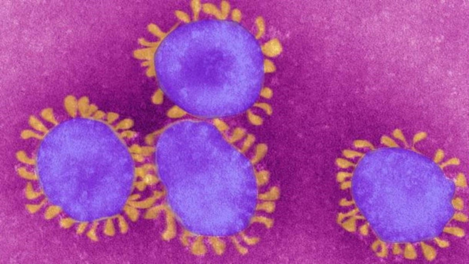 Doutorando da UFV participa da criação de modelo computacional que prevê risco de incidência do coronavírus