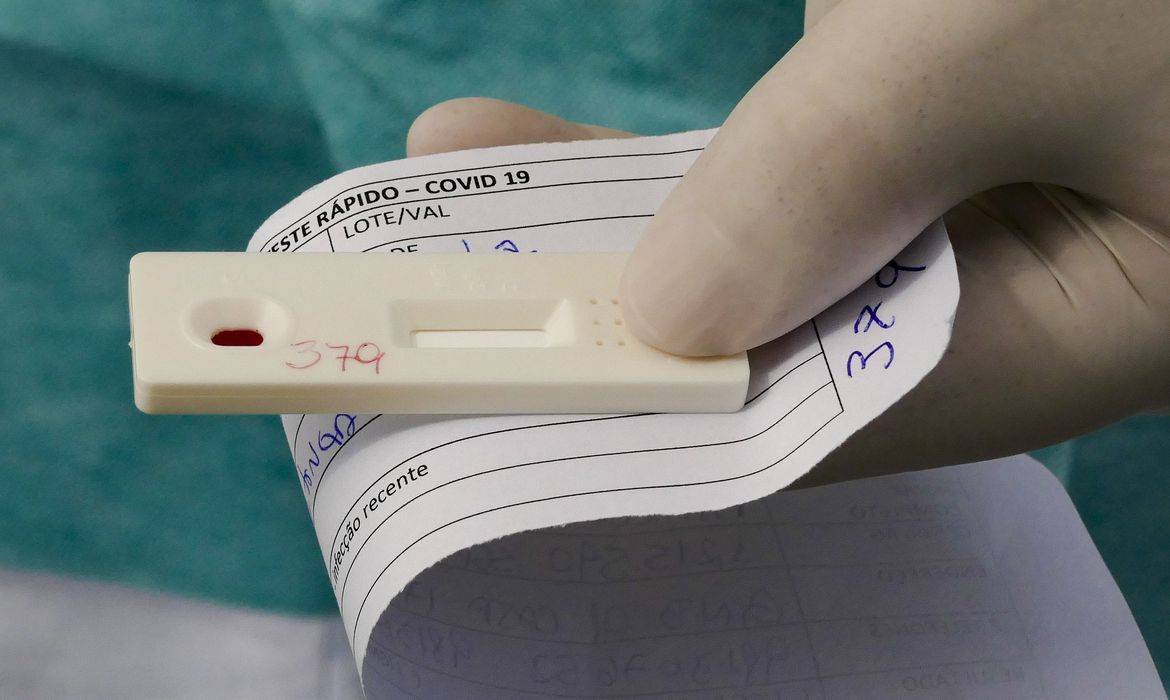 Viçosa registrou 16 casos positivos de Covid-19 na última semana