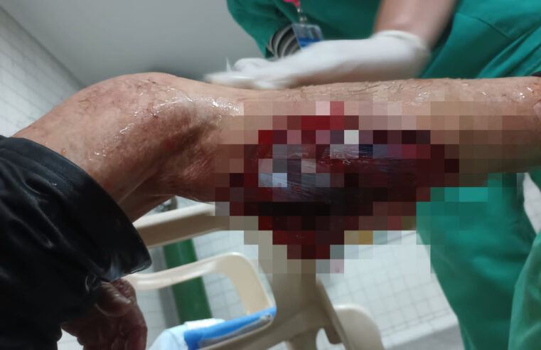 Viçosa: Idoso é atacado por cães durante caminhada