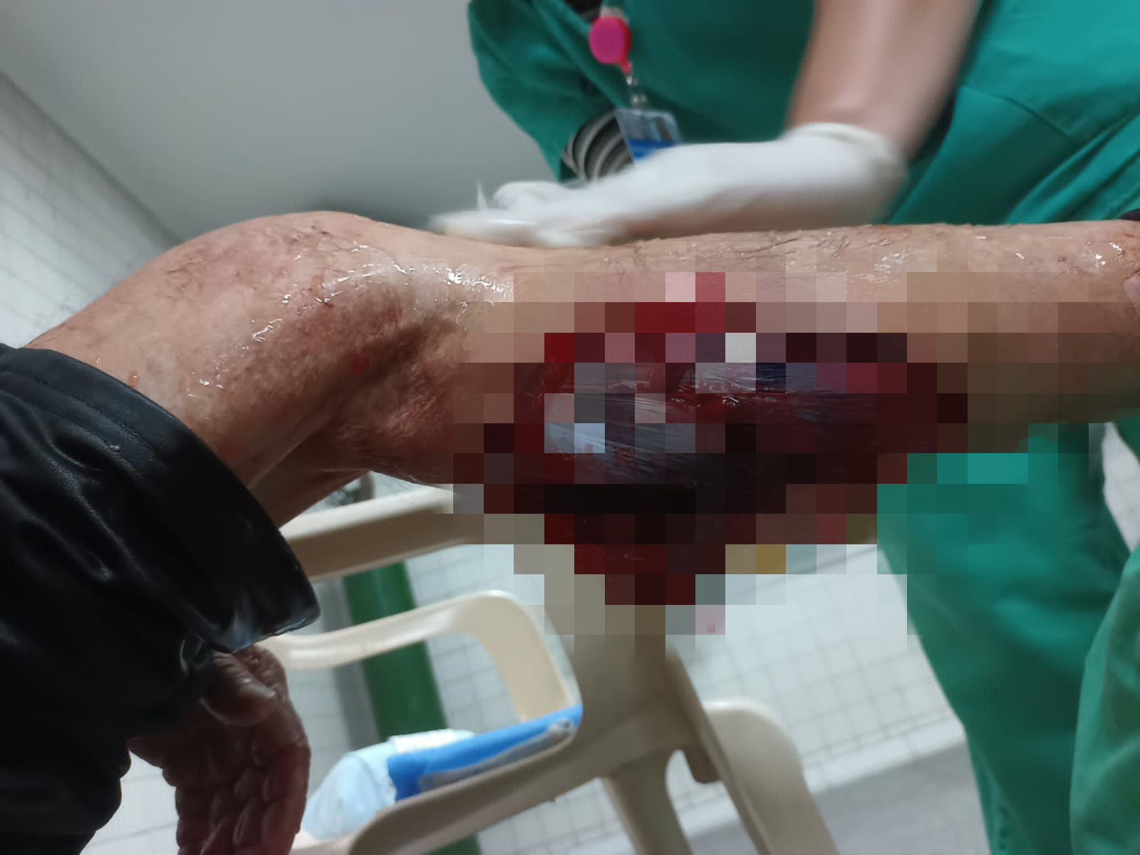 Viçosa: Idoso é atacado por cães durante caminhada