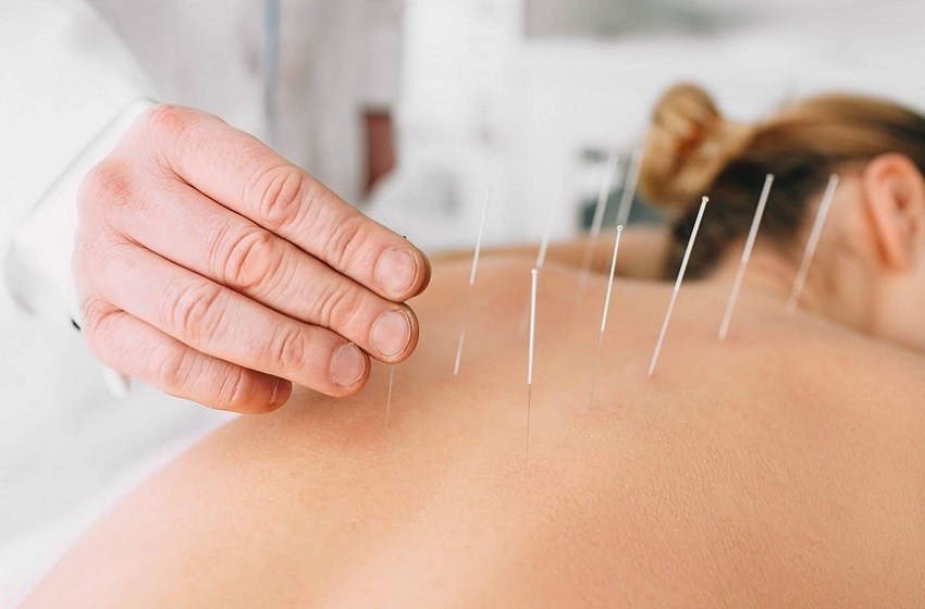 Projeto do DEM tem inscrições abertas para terceira capacitação em acupuntura auricular