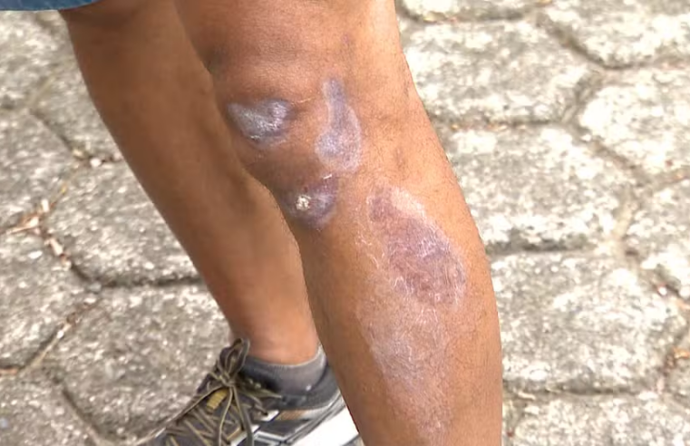 Zona da Mata: fio solto joga motociclista para o alto