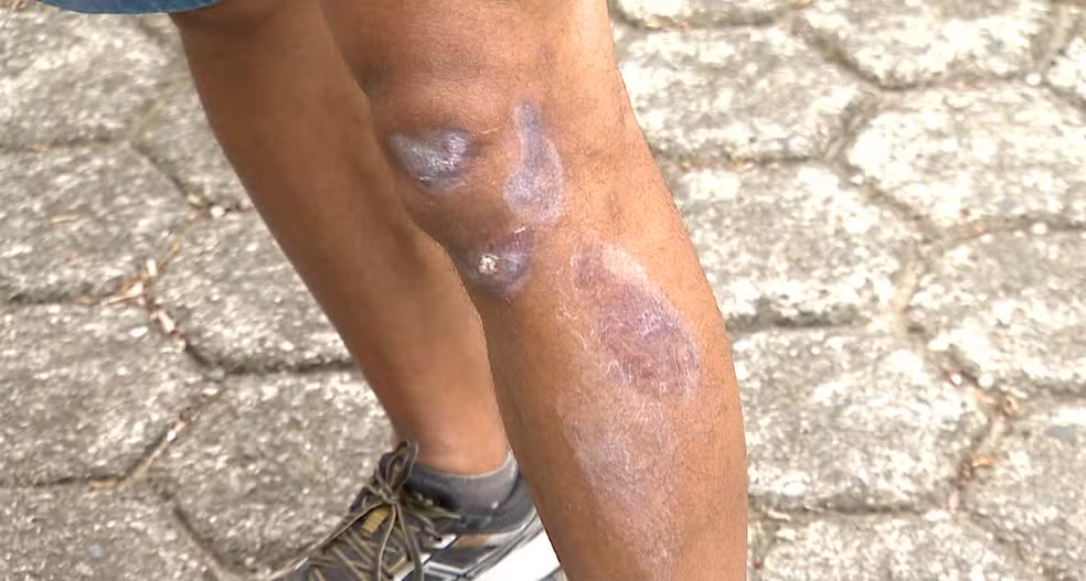 Zona da Mata: fio solto joga motociclista para o alto