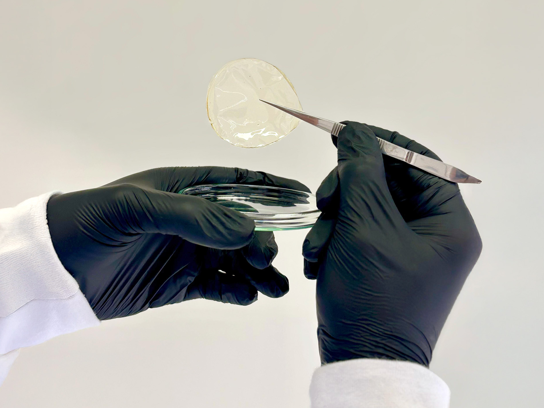 UFV inova com curativo biodegradável e inteligente para feridas