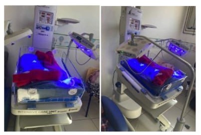 Hospital São Sebastião recebe novos equipamentos para tratamento de icterícia em recém-nascidos