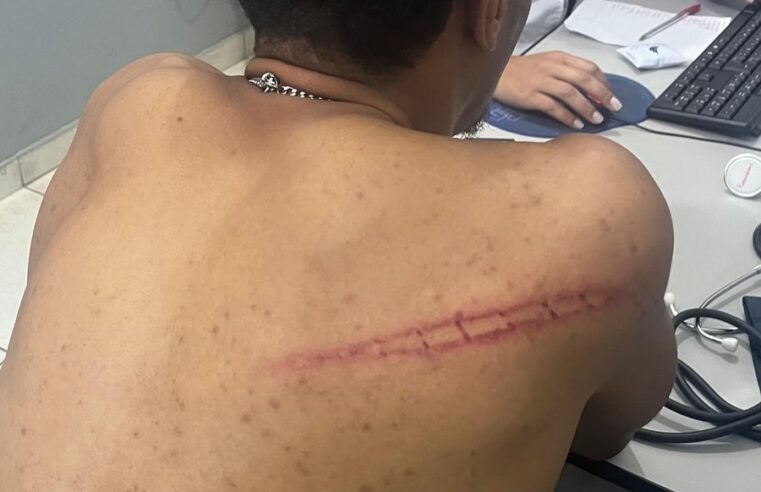 Assessor parlamentar denuncia violência policial em conflito na Avenida Santa Rita