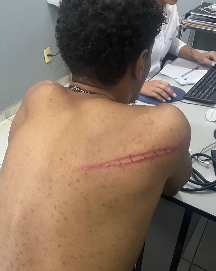 Assessor parlamentar denuncia violência policial em conflito na Avenida Santa Rita
