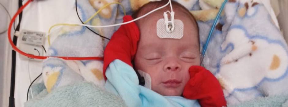 Hospital Regional João Penido, em Juiz de Fora, moderniza assistência neonatal com novos aparelhos de triagem auditiva