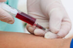 Exame de sangue para identificar sinais de mais de 50 tipos de câncer chega ao Brasil