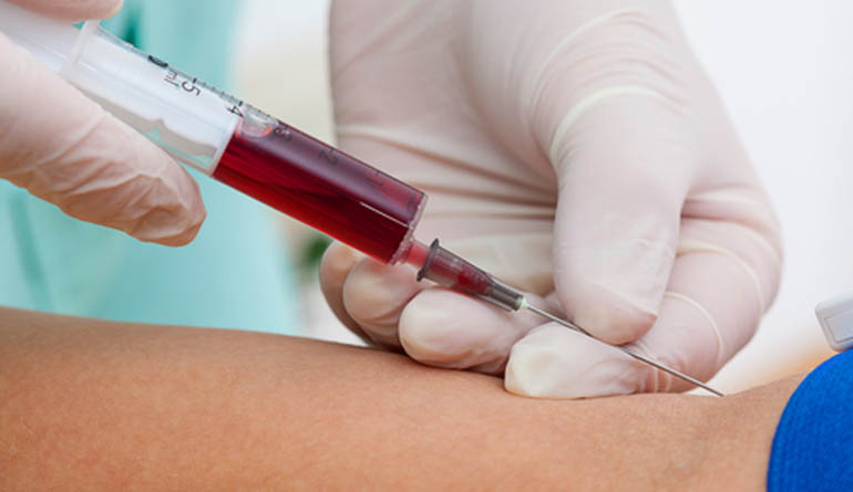 Exame de sangue para identificar sinais de mais de 50 tipos de câncer chega ao Brasil